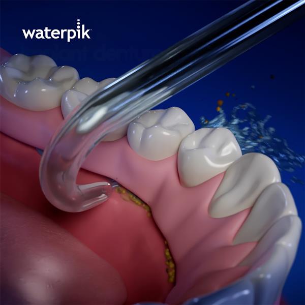 Implant Denture Tip DT-100E | Replacement Tips