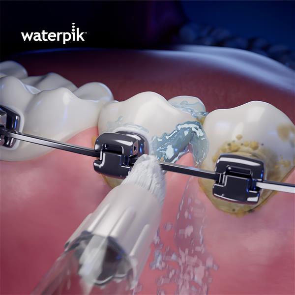 Whitening Orthodontic Tip WOD-2E | Replacement Tips